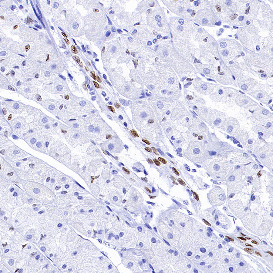 IL-33 Recombinant Rabbit mAb (S-1700-223)