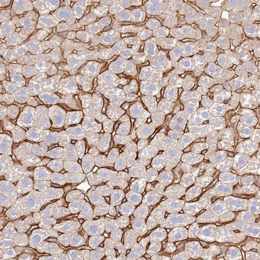 Scavenging Receptor SR-BI Recombinant Rabbit mAb (S-1736-15)