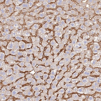 Scavenging Receptor SR-BI Recombinant Rabbit mAb (S-1736-15)
