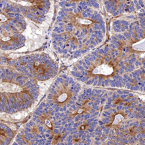 PKA C-α Recombinant Rabbit mAb (S-2564-5)