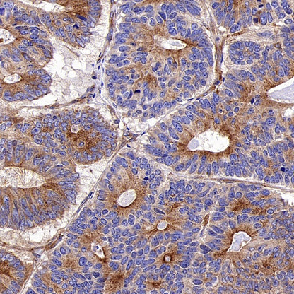 PKA C-α Recombinant Rabbit mAb (S-2564-5)