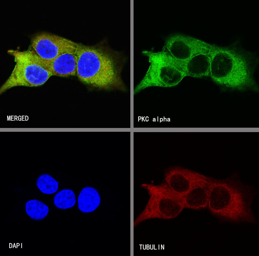 PKC alpha Recombinant Rabbit mAb (S-624-36)