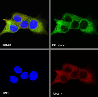 PKC alpha Recombinant Rabbit mAb (S-624-36)