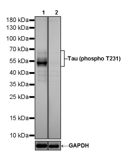 Tau (phospho T231) Recombinant Rabbit mAb (SDT-177-1)
