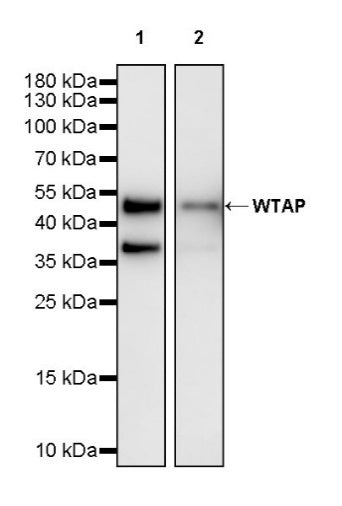 WTAP Recombinant Rabbit mAb (S-2741-49)