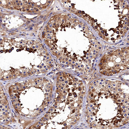 Hamartin/TSC1 Recombinant Rabbit mAb (S-2725-166)