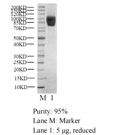 PKCα GST Tag Protein, Human