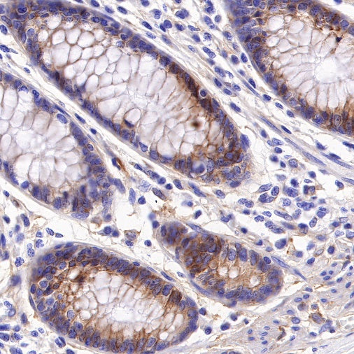 B7-H3 Recombinant Rabbit mAb (SDT-249-26)