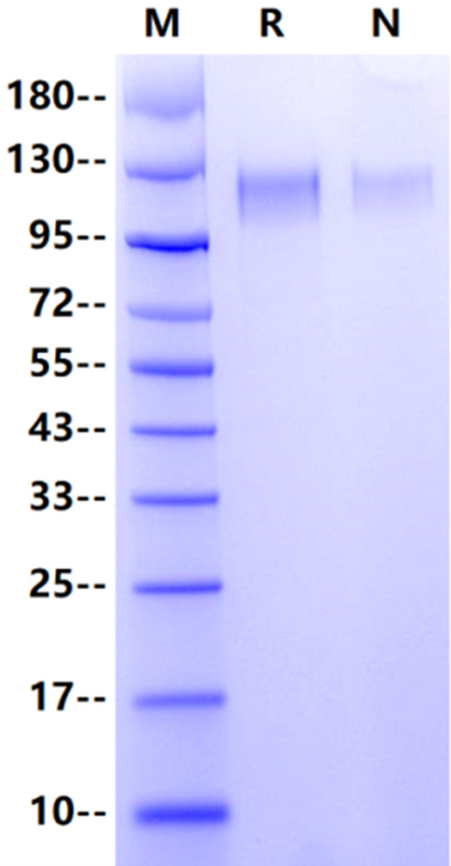 Leptin R/CD295 His Tag Protein, Human