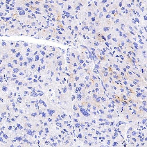 STEAP3 Recombinant Rabbit mAb (S-4466-26)