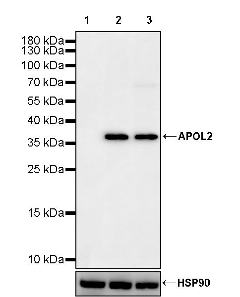 APOL2 Recombinant Rabbit mAb (S-3627-115)