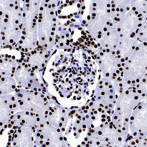 hnRNP U Recombinant Rabbit mAb (S-2375-23)