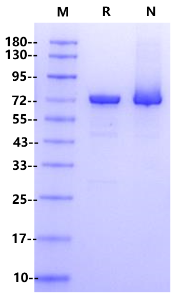 DNA Polymerase I Large (Klenow) Fragment