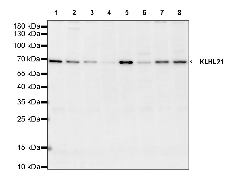KLHL21 Recombinant Rabbit mAb (S-3460-252)
