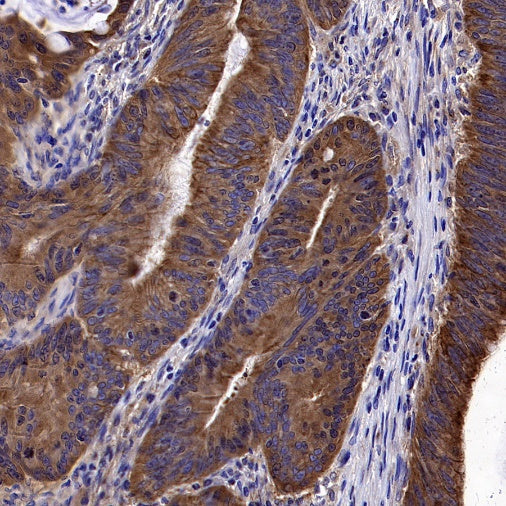 gamma Tubulin Recombinant Rabbit mAb (S-2204-13)