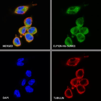 ELP3 Rabbit Polyclonal Antibody