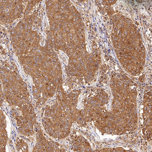 DRP1 Recombinant Rabbit mAb (S-1927-27)