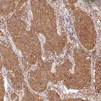 DRP1 Recombinant Rabbit mAb (S-1927-27)