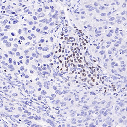 TCF1/TCF7 Recombinant Rabbit mAb (S-3486)