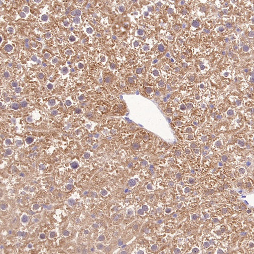 Prohibitin Recombinant Rabbit mAb (S-2679-7)