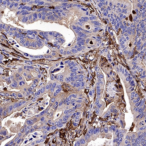 Gelsolin Recombinant Rabbit mAb (S-2522-21)