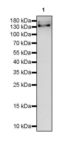 Thrombospondin 1 Recombinant Rabbit mAb (S-4153-22)