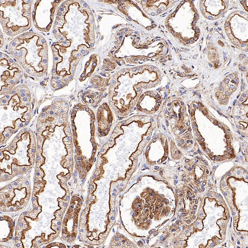Clathrin heavy chain Recombinant Rabbit mAb (S-1690-25)