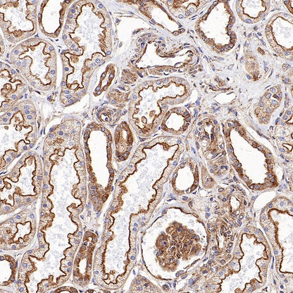Clathrin heavy chain Recombinant Rabbit mAb (S-1690-25)
