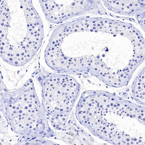 GPR64 Recombinant Rabbit mAb (S-1919-10)