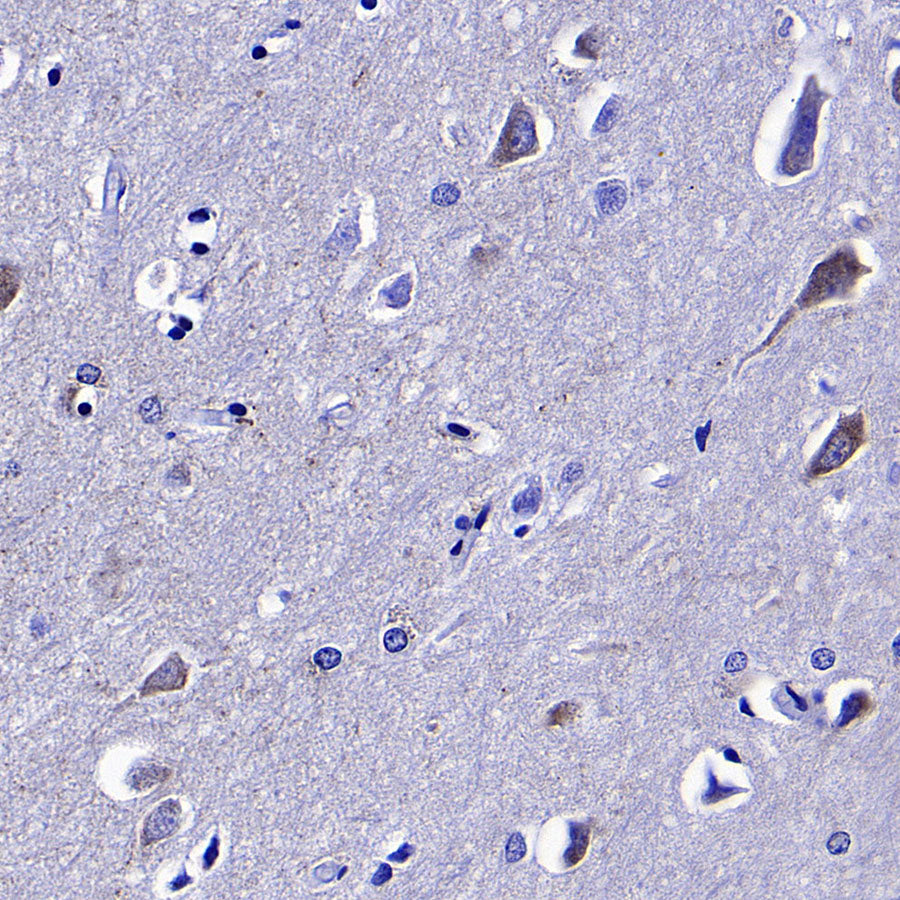 Monoamine Oxidase B/MAOB Recombinant Rabbit mAb (S-5317)