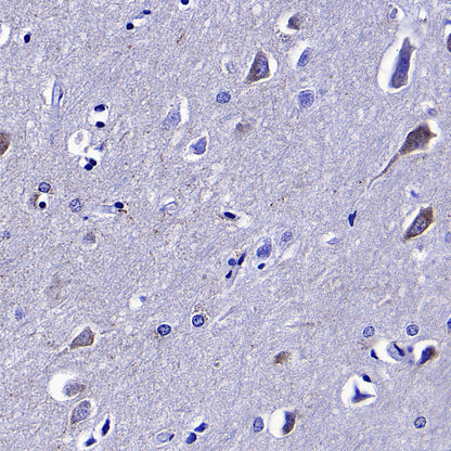 Monoamine Oxidase B/MAOB Recombinant Rabbit mAb (S-5317)