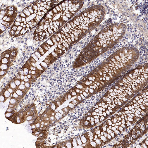 14-3-3 sigma Rabbit Polyclonal Antibody