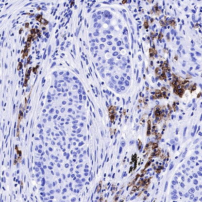 CD38 Mouse mAb (S-690-29)