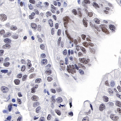 PARP1 Recombinant Rabbit mAb (S-220-179)