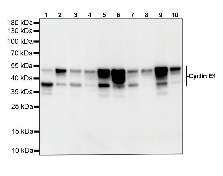 Cyclin E1 Recombinant Rabbit mAb (SDT-4375-29)