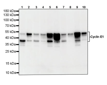Cyclin E1 Recombinant Rabbit mAb (SDT-4375-29)