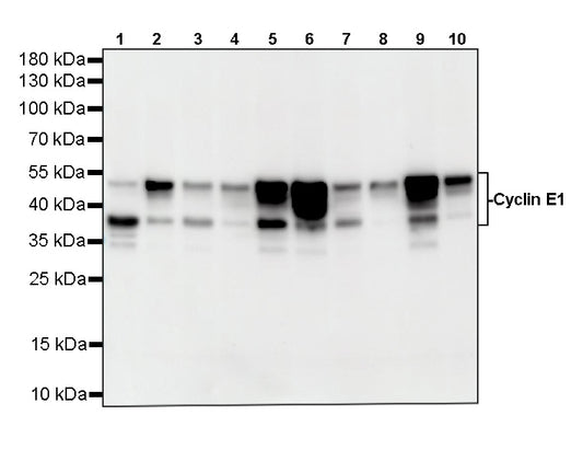 Cyclin E1 Recombinant Rabbit mAb (SDT-4375-29)