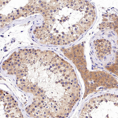 TRAF6 Recombinant Rabbit mAb (S-1087-44)