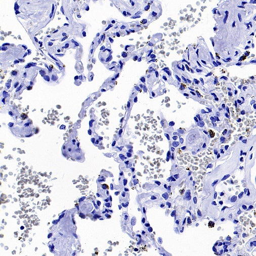 EGFR (L858R) Recombinant Rabbit mAb (SDT-421-202)