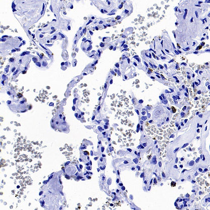 EGFR (L858R) Recombinant Rabbit mAb (SDT-421-202)