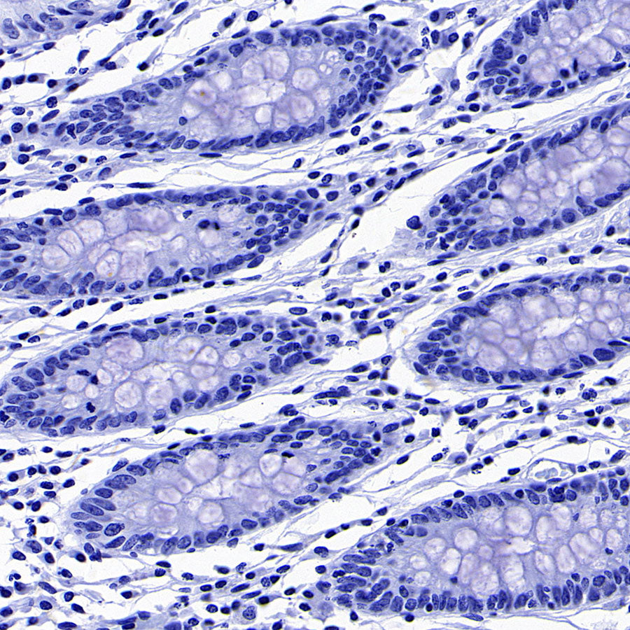 AGXT Recombinant Rabbit mAb (S-3586-30)