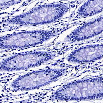 AGXT Recombinant Rabbit mAb (S-3586-30)