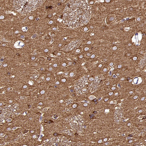 α/β-Tubulin Antibody Rabbit Polyclonal Antibody