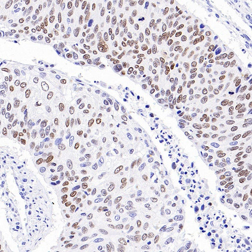 p40 Recombinant Rabbit mAb (SDT-166-116)