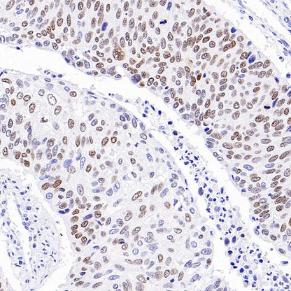 p40 Recombinant Rabbit mAb (SDT-166-116)