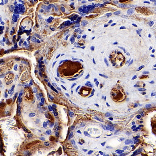 TRF Recombinant Rabbit mAb (S-613-85)