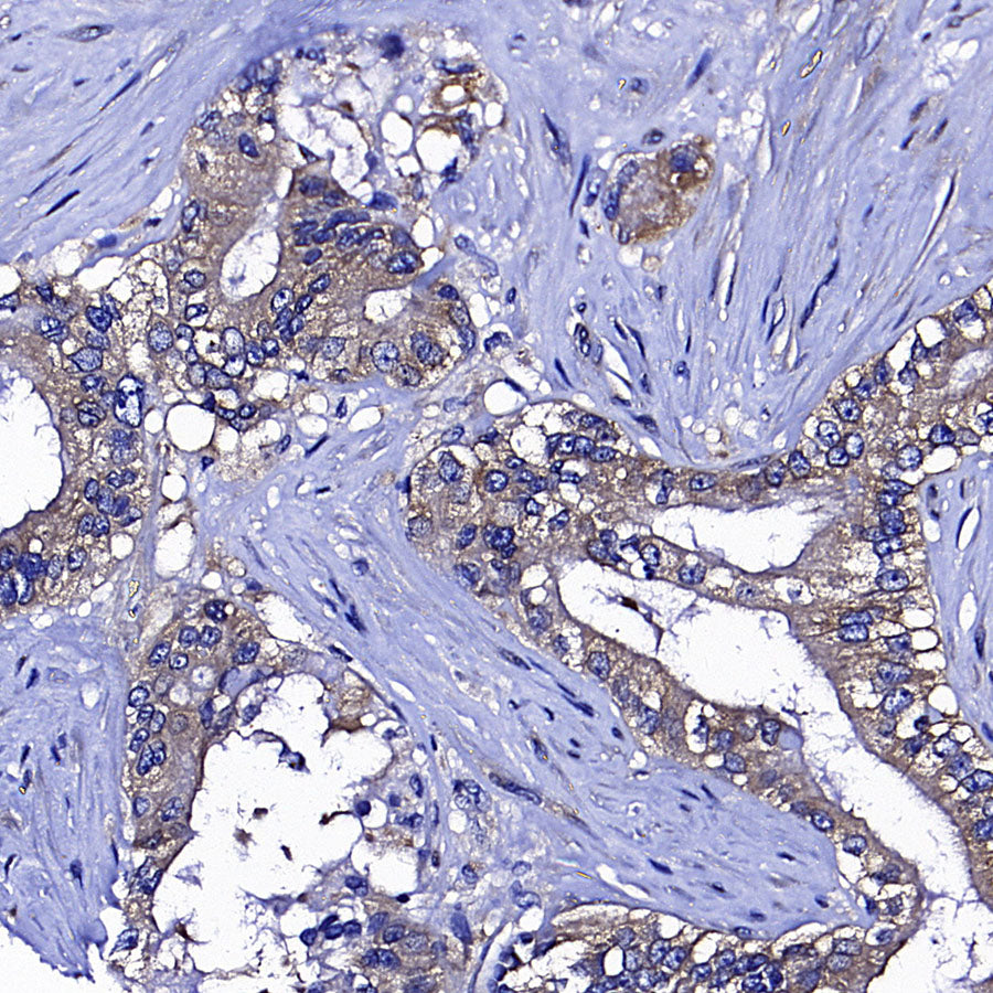 Upf1 Rabbit Polyclonal Antibody