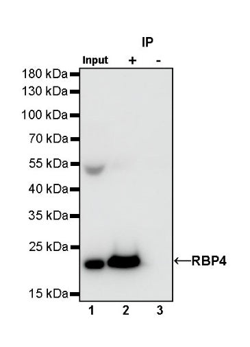 RBP4 Recombinant Rabbit mAb (S-693-111)