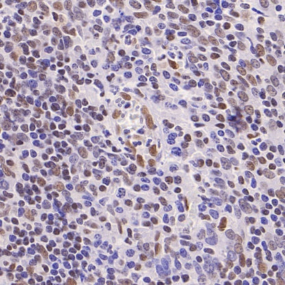 Phospho-ATF-2 (Thr71)/ATF-7 (Thr53) Recombinant Rabbit mAb (S-3535)