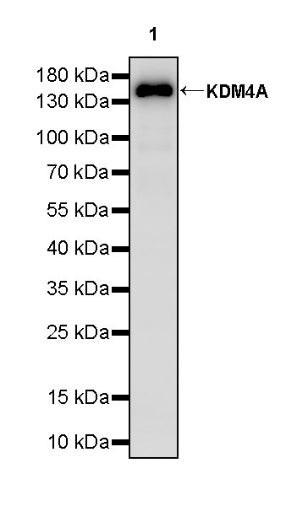 KDM4A Recombinant Rabbit mAb (S-957-138)